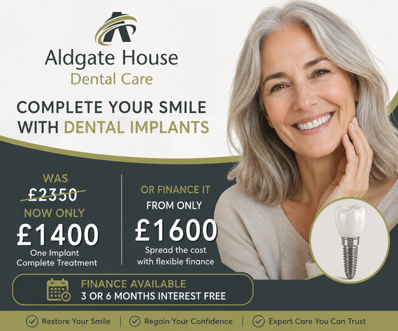 Composite Bonding Whitechapel, London | Aldgate Dental Care